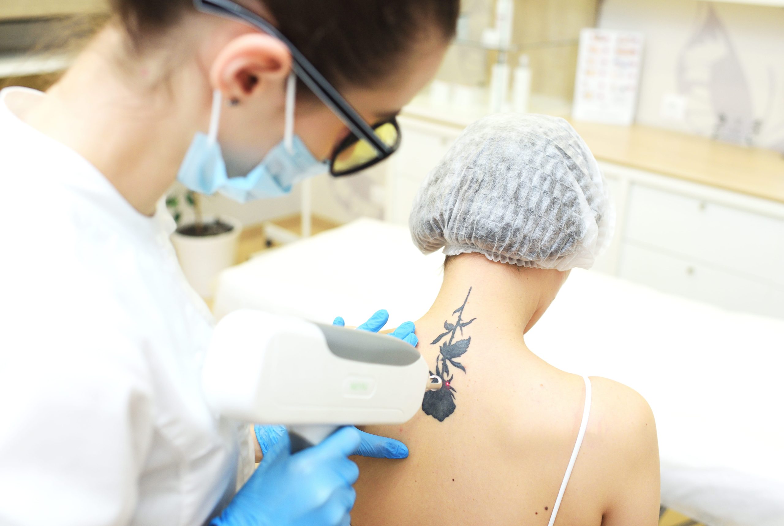 cosmetologist-removes-the-tattoo-to-the-patient-us-2023-02-17-18-33-38-utc (2)